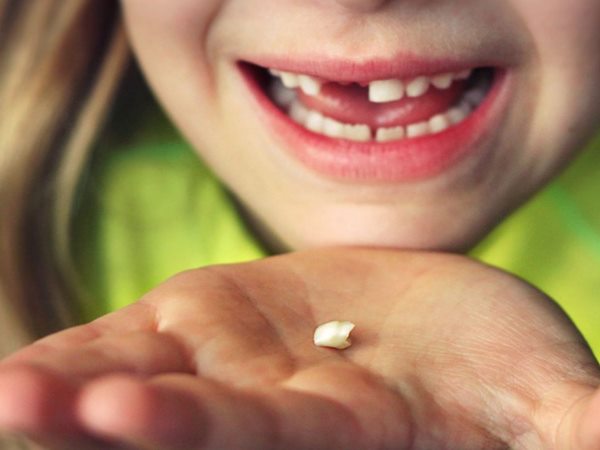 mơ thấy rụng nhiều răng 2 mơ thấy rụng nhiều răng 2