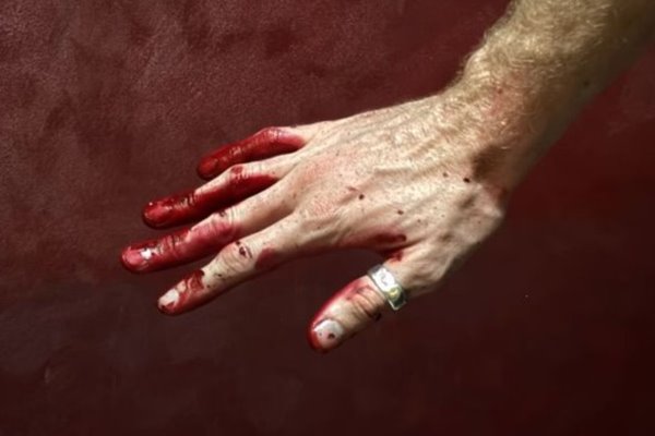 Mơ thấy bị chảy máu đánh con gì? Giải mã điềm báo và bộ số tài lộc 2