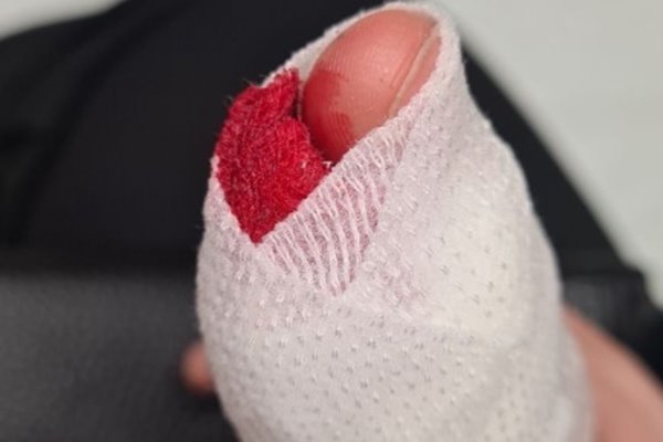 Mơ thấy đánh nhau chảy máu giải mã ý nghĩa và con số chuẩn nhất 3