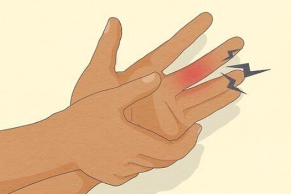 Nằm mơ thấy đứt tay đánh con gì? Con số may mắn nào sẽ xuất hiện 3