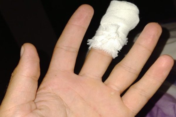 Nằm mơ thấy đứt tay đánh con gì? Con số may mắn nào sẽ xuất hiện 2