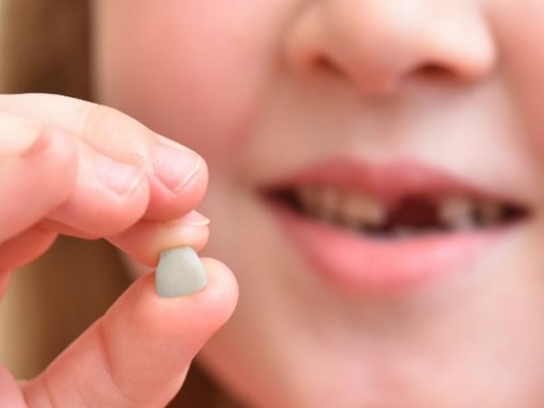 Nằm mơ thấy gãy răng báo hiệu điều Tốt hay Xấu? Giải mã con số may mắn 1 Nằm mơ thấy gãy răng báo hiệu điều Tốt hay Xấu? Giải mã con số may mắn 1