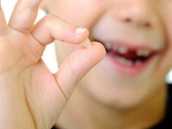 Nằm mơ thấy gãy răng báo hiệu điều Tốt hay Xấu? Giải mã con số may mắn 3 Nằm mơ thấy gãy răng báo hiệu điều Tốt hay Xấu? Giải mã con số may mắn 23