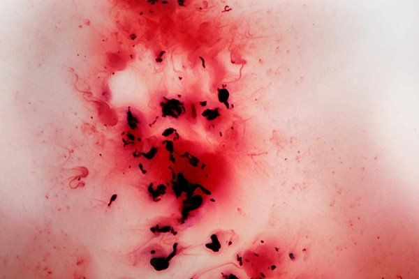 Mơ thấy máu kinh giải mã điềm báo tâm linh và con số may mắn 2 Mơ thấy máu kinh giải mã điềm báo tâm linh và con số may mắn 2