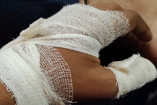 Nằm mơ thấy người khác chảy máu đánh con gì? Giải mã con số đẹp 4