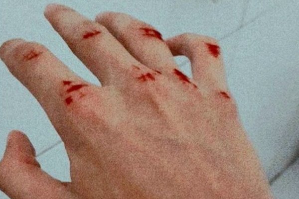 Nằm mơ thấy người khác chảy máu đánh con gì? Giải mã con số đẹp 2