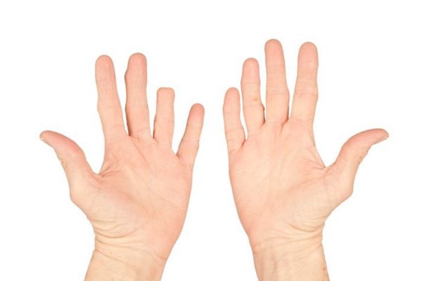 Nằm mơ thấy đứt ngón tay lời cảnh báo trước từ tiềm thức 1 Nằm mơ thấy đứt ngón tay lời cảnh báo trước từ tiềm thức 1