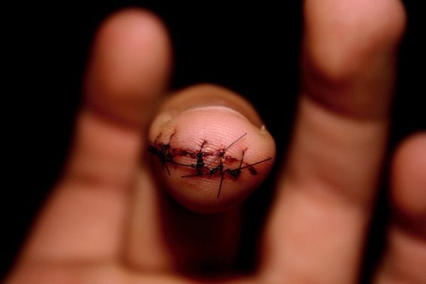 Nằm mơ thấy đứt ngón tay lời cảnh báo trước từ tiềm thức 2 Nằm mơ thấy đứt ngón tay lời cảnh báo trước từ tiềm thức 2