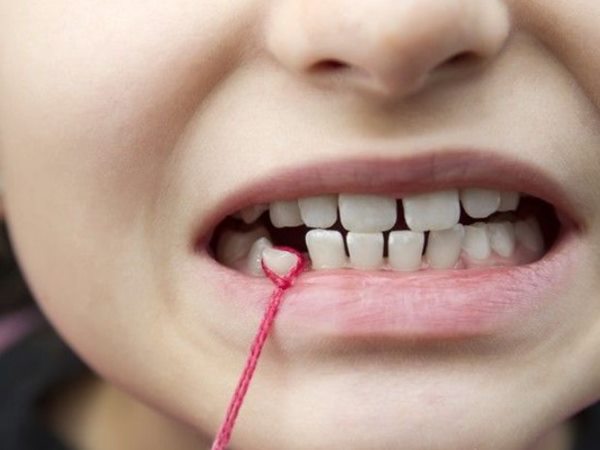 Nằm mơ thấy rụng răng không chảy máu2 Nằm mơ thấy rụng răng không chảy máu 2